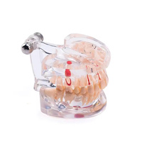 32 dientes mes completo implante enfermedad dientes modelo claro diseño implatn dientes estudio modelo dentsit uso patología dental modelo