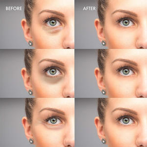 Mascarilla de Ojos Calmante de Marca Privada OEM, Antiarrugas, Ojeras, Hidratante, Aloe Vera, Colágeno - Product Image 3