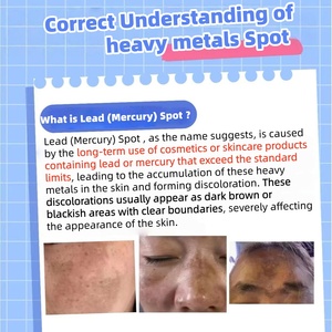 Iperpigmentazione causata da metalli pesanti nei cosmetici 4 In1 macchia della pelle Melasma per la pigmentazione del viso Peel rimuovere il Set di trattamento - Product Image 2