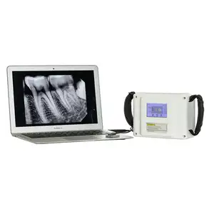 牙科用品医用无线高频逆变器手持式便携式牙科x光传感器数字x光