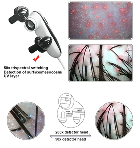 Máquina de Análisis de Piel y Cabello con Cámara <span class=keywords><strong>HD</strong></span> Facial, Conexión USB Portátil, Diseño Único, con Detección de Acné - Product Image 6
