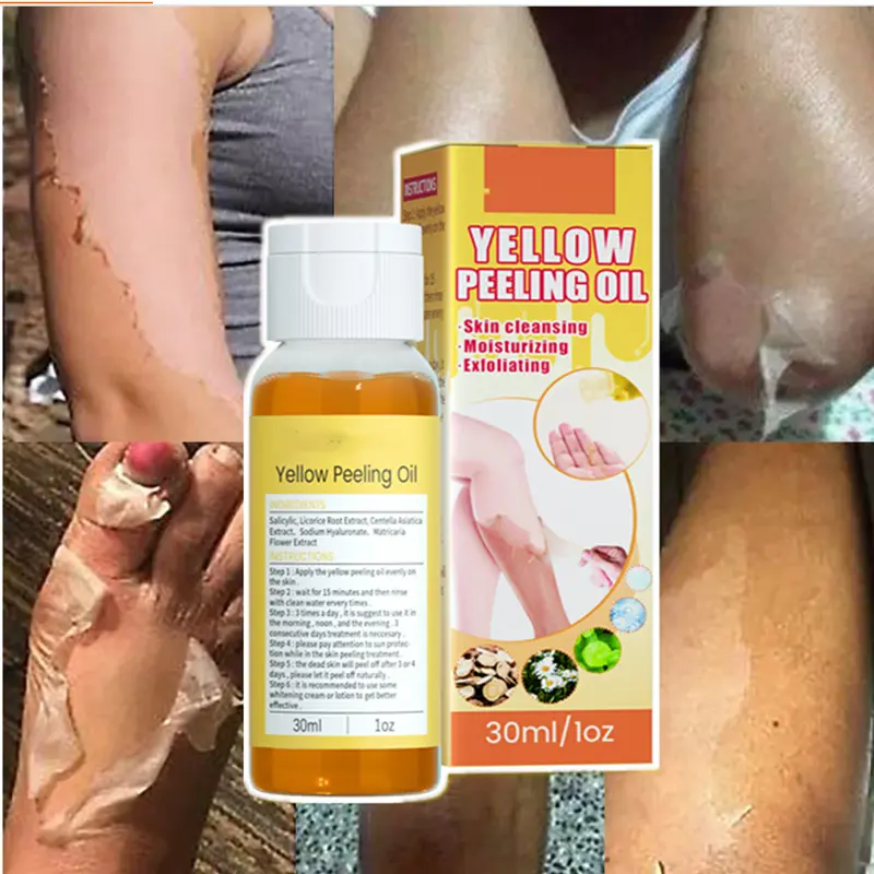 Toptan cilt bakımı kozmetik güzellik ürünleri temizleme nemlendirici peeling karanlık nokta kaldırma cilt bakımı sarı peeling yağı