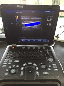 Ce Veterinaire SUN-906B Portatil Gespecialiseerde Cardiale Diagnostiek Laptop Kleur <span class=keywords><strong>Doppler</strong></span> Voor Dieren - Product Image 3