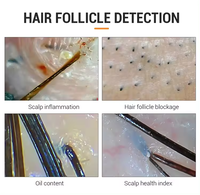 Hot Sale 101C Hair Analyzer HD Skin and Scalp Scanner Detector Hair Follicles for Face and Body Analysis with US/EU Plugs