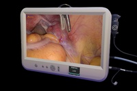 Système de caméra endoscopique pour animaux intégré 1080P avec sortie HDMI pour examen d'arthroscopie, écran LCD intégré de 22 pouces