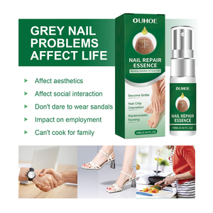 Sérum réparateur <span class=keywords><strong>pour</strong></span> <span class=keywords><strong>ongles</strong></span> en gros, ingrédients naturels, soin <span class=keywords><strong>des</strong></span> champignons, améliore l'jaunissement <span class=keywords><strong>des</strong></span> <span class=keywords><strong>ongles</strong></span>, hydratant, solution de réparation du <span class=keywords><strong>vernis</strong></span> à <span class=keywords><strong>ongles</strong></span> - Product Image 3