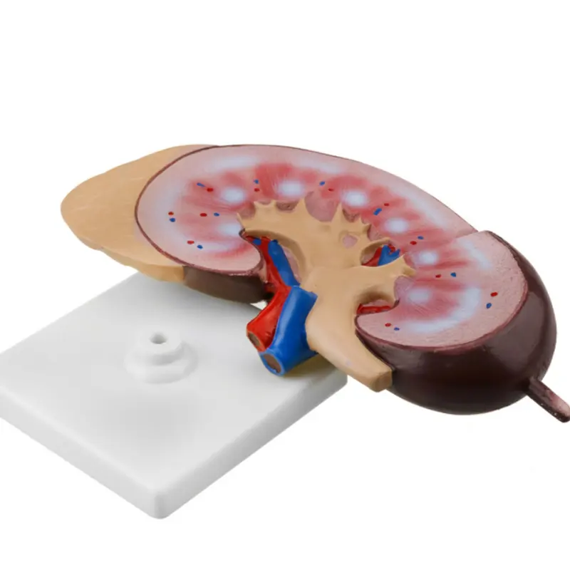 Human Kidney Model Nephron Glomerular Kidney Anatomy Teaching Model
