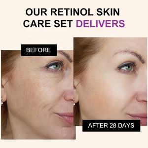 Etiqueta privada Retinol <span class=keywords><strong>Kit</strong></span> DE CUIDADO DE LA PIEL antienvejecimiento Hidratante Rutina facial para mujeres - Product Image 4