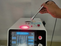 Appareil de thérapie de raffermissement cutané par liposuccion minimalement invasive à double longueur d'onde 980 nm et 1470 nm