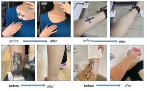 6 Parches Adhesivos Impermeables para Cubrir Tatuajes, Ultrafinos, para Disimular Imperfecciones - Product Image 6