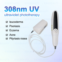 Portable 308nm UVB Photothérapie Excimer Laser Vitiligo Psoriasis Crème Traitement Lampe Uv Photothérapie Luminothérapie Machine