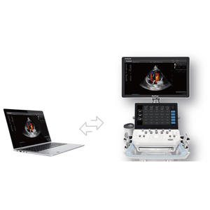 Échographe abdominal et de grossesse vétérinaire Sonoscape ProPet 60 pour diagnostic de base - Product Image 5