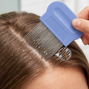 Peine para Piojos de Acero Inoxidable, Removedor de Huevos de Piojo de Alta Calidad con Dientes Densos, Herramienta de Tratamiento Capilar, Logotipo OEM Personalizado - Product Image 5