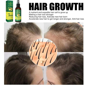 Herbicos Green Ginger Anti-Hair Verhindert Verlust Öl, Ingwer 7 Tage Haarwuchs Pflegendes Nachwachsen <span class=keywords><strong>Spray</strong></span>,King Of Ginger Sprühen - Product Image 4