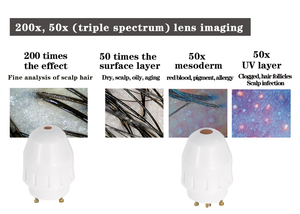 Détecteur de follicules pileux et de cuir chevelu portable 50X à 3 spectres, 10MP avec amplification 50x et 200x, détection trispectrale HD - Product Image 5