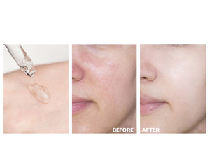 Siero Viso alla Vitamina <span class=keywords><strong>C</strong></span> con Marchio Privato, Essenza Liquida Illuminante e Sbiancante per la Pelle - Product Image 6