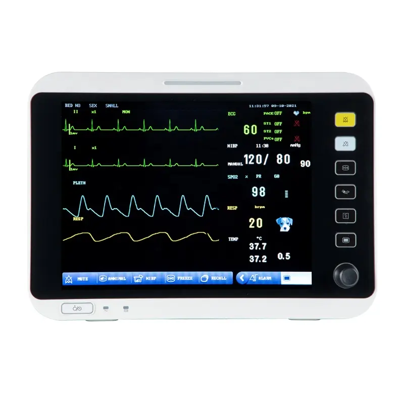 Monitor veterinario portátil, sistema de monitoreo de presión arterial, NIBP, temperatura, capógrafo, Etco2, clínica veterinaria, precio barato