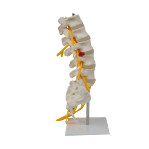 Modelo de Columna Vertebral de PVC de Alta Calidad con 5 Vértebras, Sacro, Nervios Caudales y Modelo Esquelético para Educación Médica, Hospitales y Uso Médico - Product Image 5