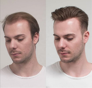 Longfor BMEIYI uomo di alta qualità indiano Remy <span class=keywords><strong>capelli</strong></span> umani parrucchino con pizzo BIO Base <span class=keywords><strong>extension</strong></span> per <span class=keywords><strong>capelli</strong></span> - Product Image 3