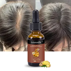 Istennok Ginger Hair Growth Essential Oil Natural Anti Hair Loss Fast Grow Prevent Baldness Treatment Liquid Men Women