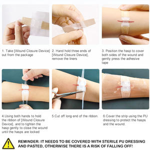 Cinta Adhesiva Estéril para Primeros Auxilios, Apósito Quirúrgico Transparente, Tira Adhesiva Estéril para Reparación <span class=keywords><strong>de</strong></span> la Piel, para Uso en el Hogar y al Aire Libre - Product Image 6