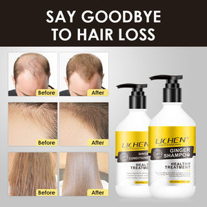 Shampooing <span class=keywords><strong>pour</strong></span> la croissance des cheveux Lichen <span class=keywords><strong>pour</strong></span> hommes et femmes, sans sulfate, <span class=keywords><strong>meilleur</strong></span> shampooing et revitalisant <span class=keywords><strong>pour</strong></span> la croissance des cheveux - Product Image 6
