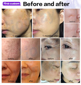 Appareil portable 9 en 1 pour soins de la peau à froid avec écran de 10,4 pouces pour l'élimination de la pigmentation, le soin anti-âge et l'élimination de l'acné - Product Image 6