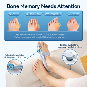Tipsie Machine <span class=keywords><strong>Forefoot</strong></span> China Chaussettesシリコンコーチアリケート卸売業者用品ブレースウェアラブルハンドリハビリテーション - Product Image 3