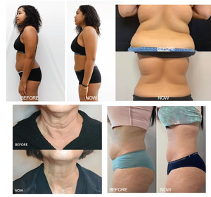 Nouveauté : Machine d'analyse de la peau du visage C9 Cryoskin, scanner professionnel de la peau du visage pour les spas, salons de beauté, réduction de la cellulite - Product Image 6