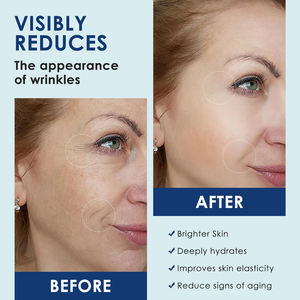 Venta al por mayor suero de retinol ordinario antienvejecimiento antiarrugas cuidado de la piel suero de retinol vegano con ácido hialurónico y colágeno - Product Image 6