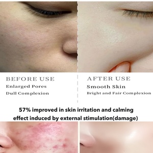 Esencia Facial Purificante Vegana <span class=keywords><strong>No</strong></span> Comedogénica <span class=keywords><strong>Corrector</strong></span> de Manchas Oscuras y Imperfecciones Cuidado de la Piel Coreano para Piel Grasa Sensible y Desigual MRUIS Venta al por Mayor - Product Image 5