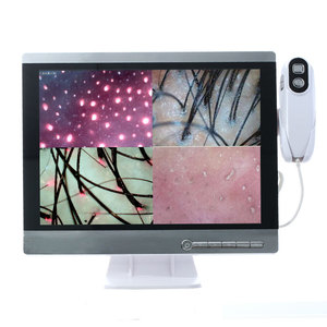 SkySpirit profissional Hd cabelo folículos couro cabeludo scanner detector cabelo analisador/pele e máquina análise cabelo couro cabeludo - Product Image 6