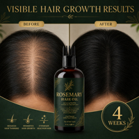 Minyak Perawatan Kulit Kepala Label Pribadi, Minyak Pertumbuhan Rambut Campuran Rosemary Khusus, Minyak Perbaikan Rambut Dengan 2 Aplikasi