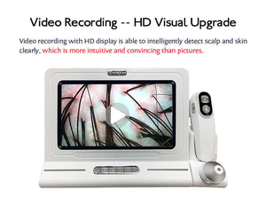 Alta definición 3D Digital Hair Scalp Analysis Máquina de terapia capilar Detección de humedad del aceite de la piel Dispositivo de diagnóstico del cuero cabelludo - Product Image 4