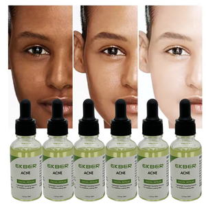 Cosméticos Coreanos, Removedor de Puntos Negros, Cuidado Facial, Antiacné, Suero Blanqueador, OEM - Product Image 5