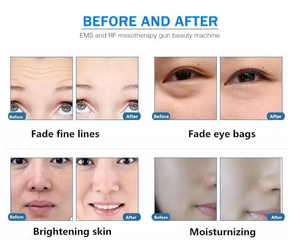 เครื่องบำบัดด้วยออกซิเจนแบบเข็ม7 in 1สำหรับการดูแลผิวและรักษาผมร่วง - Product Image 6