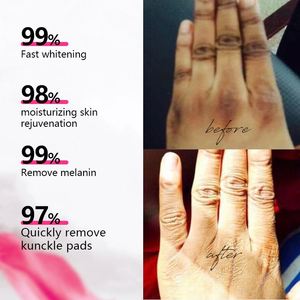 ครีมไวท์เทนนิ่งเข้มข้นสำหรับข้อศอกและหัวเข่าดำ ลดรอยดำข้อศอกและหัวเข่าอย่างง่ายดาย ได้จากโรงงานผลิตเครื่องสำอาง ขายส่ง - Product Image 3