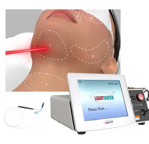 2024 efektif endoskopi medis 1470nm 980nm dioda laser pengangkat wajah mesin sedot lemak serat kanula serat optik endolaser