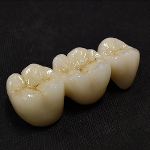 ฟันปลอม3D ไฟฟ้าสำหรับฟันเซรามิกรูปมงกุฎและพอร์ซเลนเซอร์โคเนียสำหรับฟันเทียม - Product Image 4