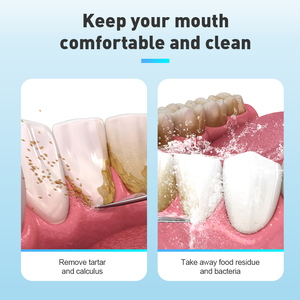 Removedor de cálculos dentales para el hogar, dispositivo de <span class=keywords><strong>limpieza</strong></span> ultrasónico, limpiador <span class=keywords><strong>dental</strong></span> portátil, dispositivo de <span class=keywords><strong>limpieza</strong></span> <span class=keywords><strong>profunda</strong></span> - Product Image 3