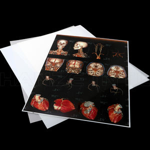 <span class=keywords><strong>Film</strong></span> bleu médical à jet d'encre pour imagerie à rayons <span class=keywords><strong>X</strong></span> <span class=keywords><strong>Ray</strong></span> <span class=keywords><strong>X</strong></span> Ortho Movie Films à rayons <span class=keywords><strong>X</strong></span> à jet d'encre 8*10 pouces 35*43cm - Product Image 6