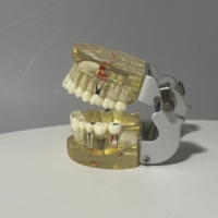 Modèle Typodont dentaire Standard pour l'étude de la maladie d'implant de pont de restauration de dents démo médicale amovible pour dentiste