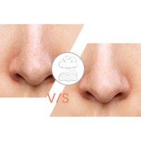 Marque privée nettoyage en profondeur dissolvant de points noirs Patch nez bandes de traitement des pores pour absorber les boutons acné hydrocolloïde nez Patch