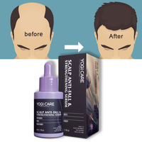 Huile de croissance rapide des cheveux à base de romarin naturel, marque privée, pour femmes noires, produit indien en gros