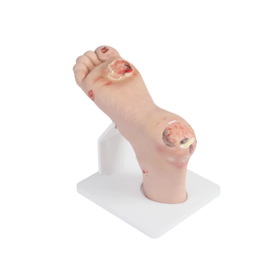 Modello didattico del piede diabetico, Modello del piede per infermieristica, Modello patologico - Product Image 2