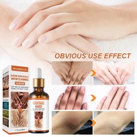 Sérum éclaircissant rapide pour les articulations foncées, correcteurs de pigmentation pour la peau noire, mains, genoux, coudes, éliminateur de taches intenses