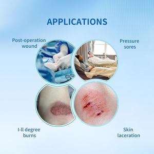 Pembalut busa untuk perawatan luka produk habis pakai berkualitas tinggi - Product Image 2