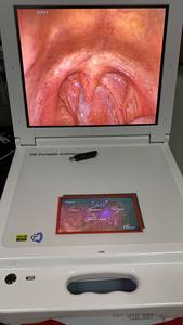 Ensemble d'endoscopie <span class=keywords><strong>Shrek</strong></span>, caméra portable pour ORL - Product Image 5