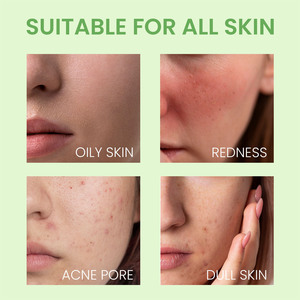 มาส์กหน้าดินสำหรับสิวหัวดำสีเขียวโคลนโคลนให้ความชุ่มชื้น - Product Image 6