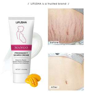 Crème corporelle <span class=keywords><strong>anti</strong></span>-vergetures à la mangue 40g, crème biologique pour la récupération post-partum, élimination des vergetures, crème pour femmes enceintes - Product Image 1